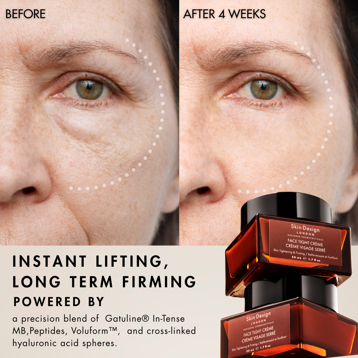 Face Tight Crème