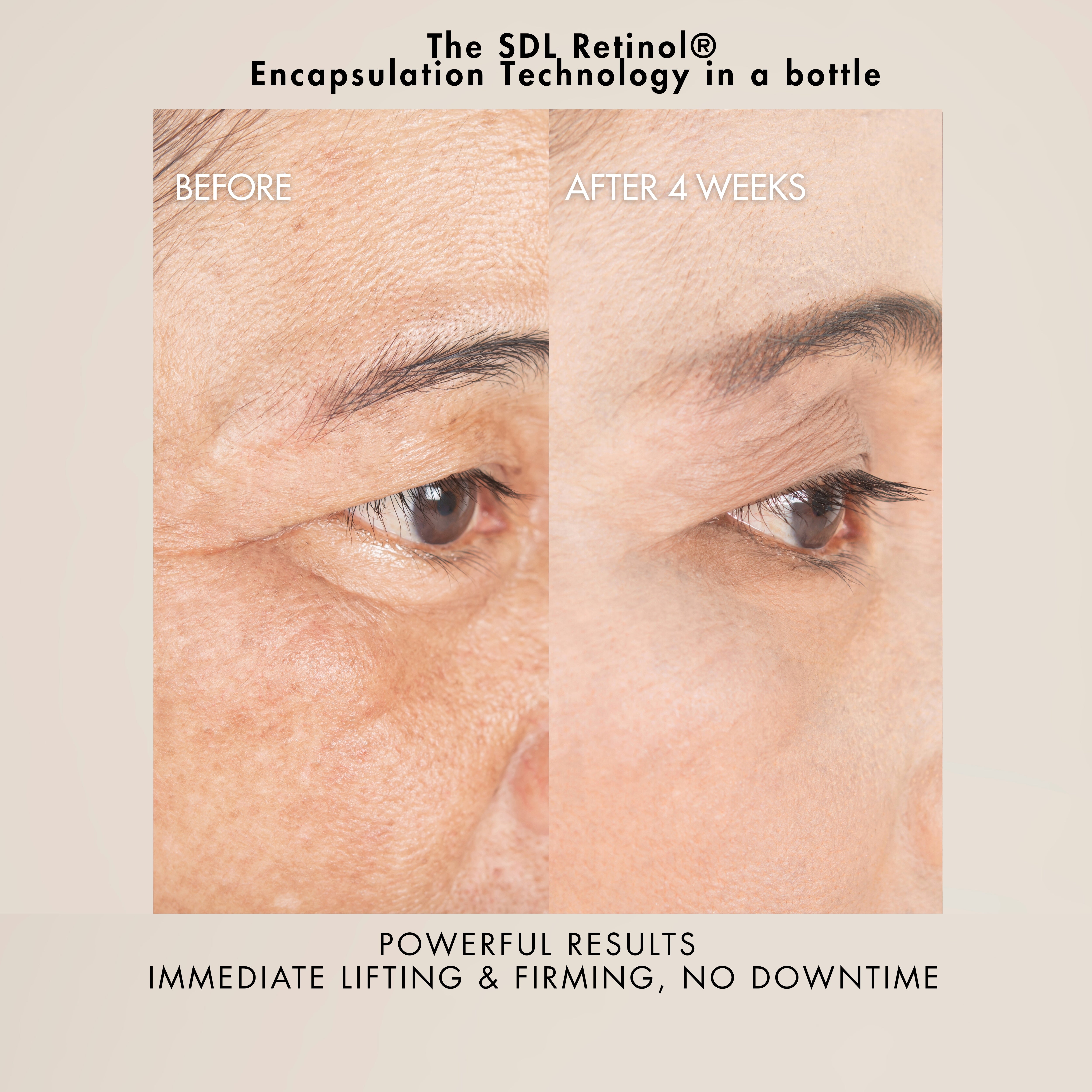Retinol Gel Crème